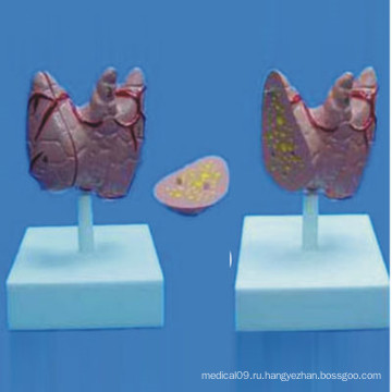 Демонстрационная модель медицинской анатомии человека щитовидной железы (R130105)